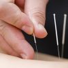 What should I do if I experience motion sickness with Chinese acupuncture? These 5 ways to help you out