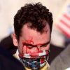 Pro-chuan march attacked, Trump children rebuke mainstream media for silence